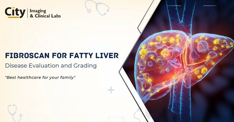 FibroScan for Fatty Liver Disease Evaluation and Grading