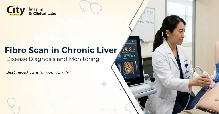 Fibro Scan in Chronic Liver Disease Diagnosis