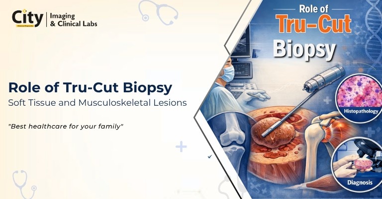 Tru-Cut Biopsy for Soft Tissue and Musculoskeletal Lesions
