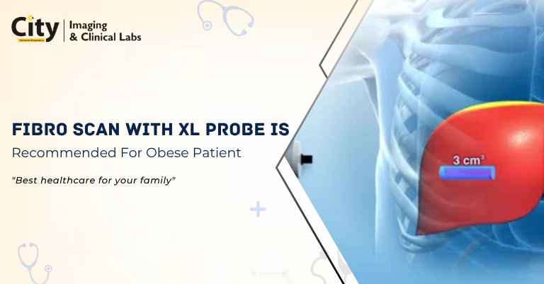 Why Fibro Scan with XL Probe Is Recommended For Obese Patient Test